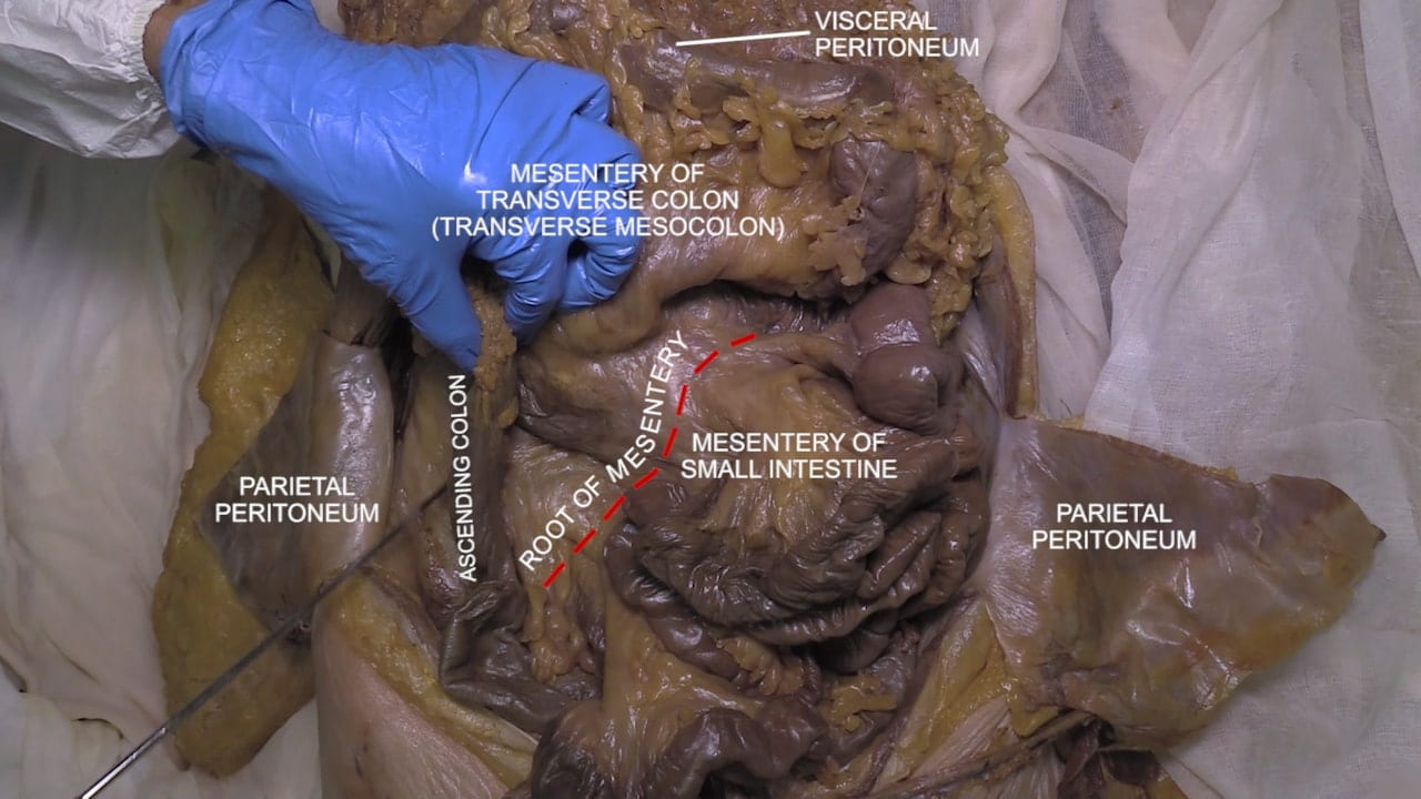 Labels (top to bottom): Visceral peritoneum, mesentery of transverse colon (transverse mesocolon), parietal peritoneum, ascending colon, root of mesentery, mesentery of small intestine, parietal peritoneum