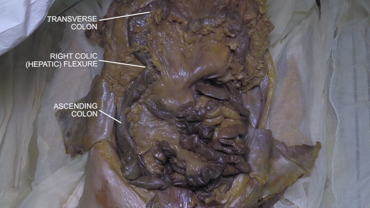 Labels (top to bottom): Transverse colon, right colic (hepatic) flexure, ascending colon