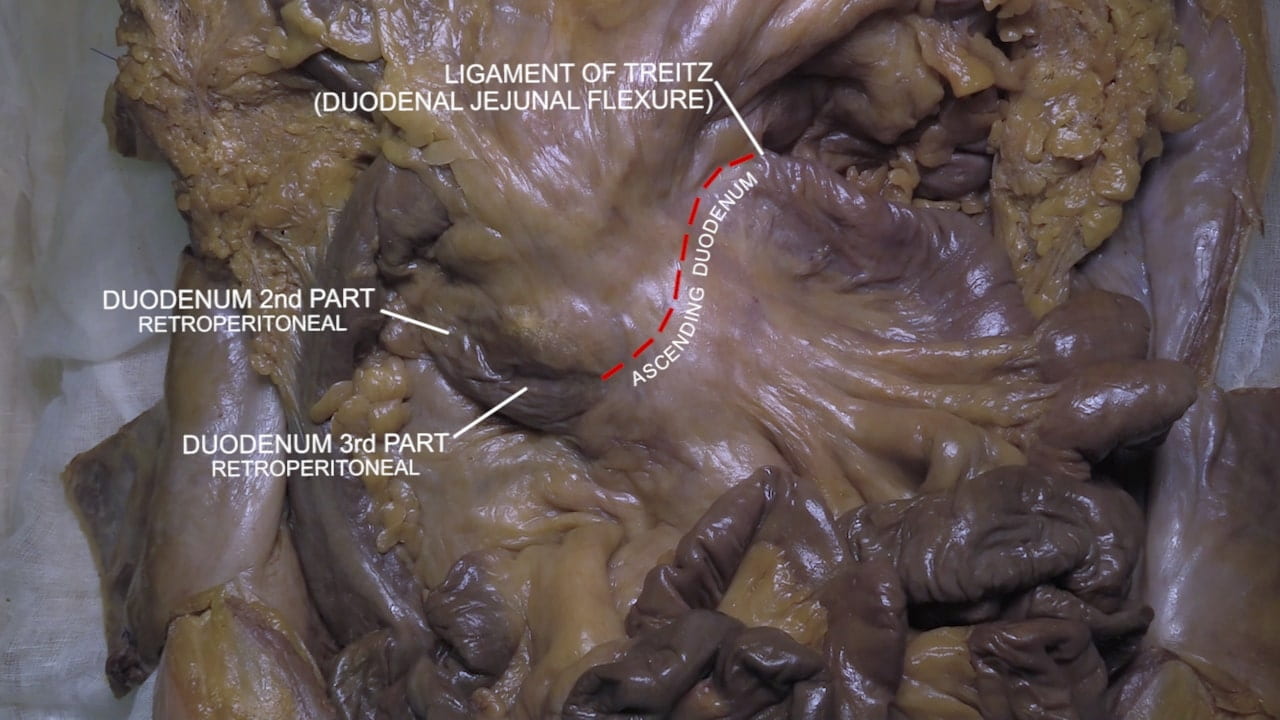 Labels (top to bottom): Ligament of Treitz (duodenal jejunal flexure, duodenum 2nd part (retroperitoneal), ascending duodenum, duodenum 3rd part (retroperitoneal)