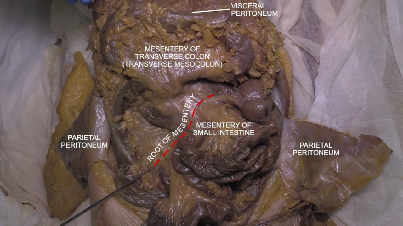 Labels (top to bottom): Visceral peritoneum, mesentery of transverse colon (transverse mesocolon), parietal peritoneum, root of mesentery, mesentery of small intestine, parietal peritoneum