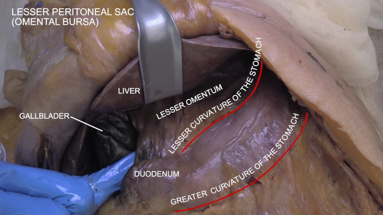 Title: Lesser peritoneal sac (omental bursa) Labels (top to bottom): Liver, gallbladder, lesser omentum, lesser curvature of the stomach, duodenum, greater curvature of the stomach