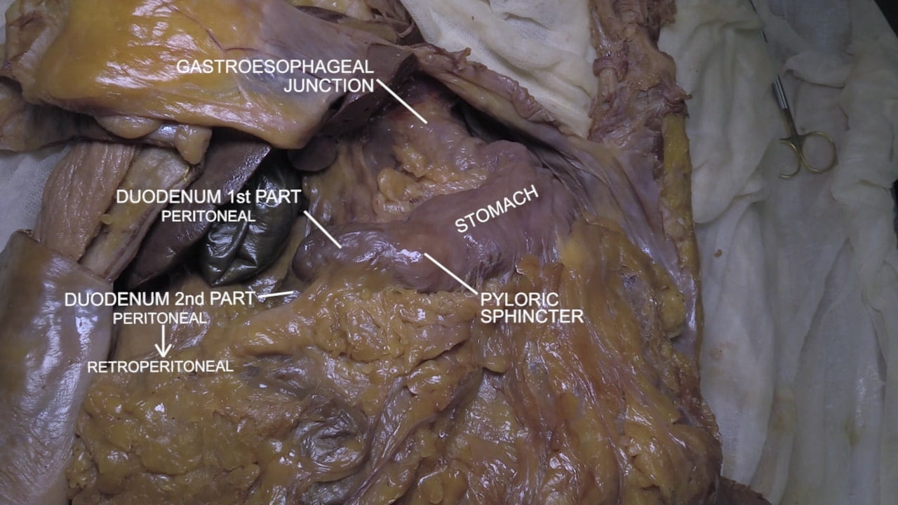 Labels (top to bottom): Gastroesophageal junction, duodenum 1st part (peritoneal), stomach, pyloric sphincter, duodenum 2nd part (peritoneal to retroperitoneal)