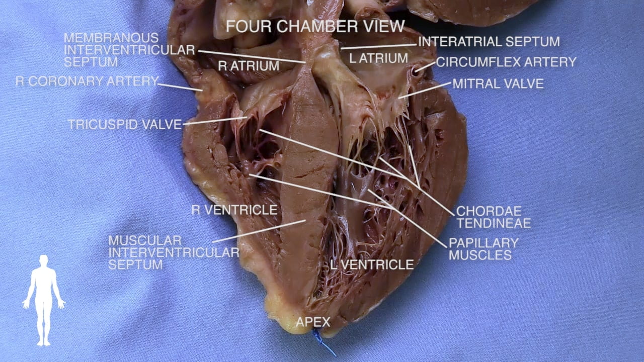 Title: Four chamber view Labels (Top to bottom): Membranous interventricular septum, intertribal septum, l atrium, circumflex artery, r atrium, r coronary artery, mitral valve, triscuspid valve, r ventricle, chordae tendineae, papillary muscles, muscular interventricular septum, l ventricle, apex