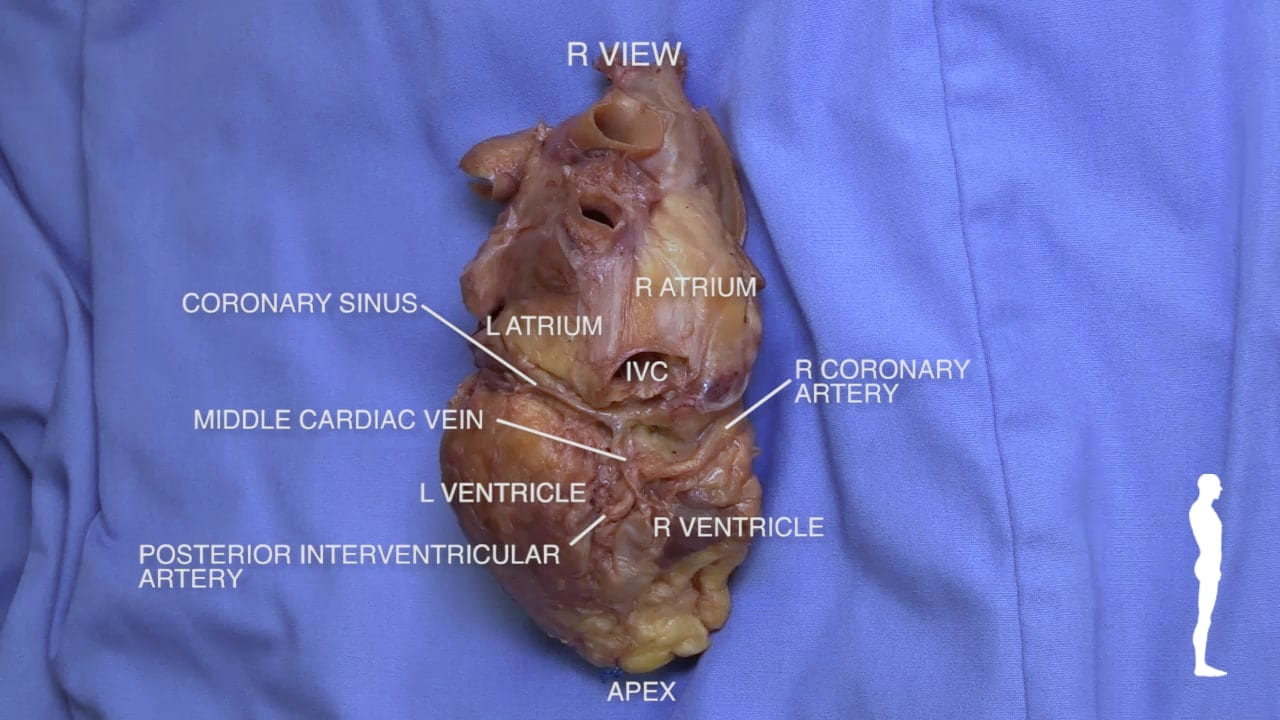 Title: R View Labels (top to bottom): Coronary sinus, R atrium, l atrium, IVC, r coronary artery, middle cardiac vein, l ventricle, r ventricle, posterior interventricular artery, apex