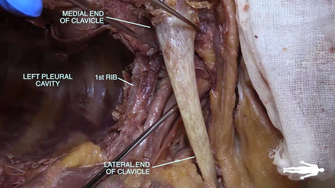 Labels (top to bottom): Medial end of clavicle, left pleural cavity, 1st rib, lateral end of clavicle