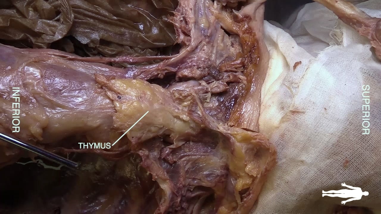 Labels (left to right): Inferior, thymus, superior