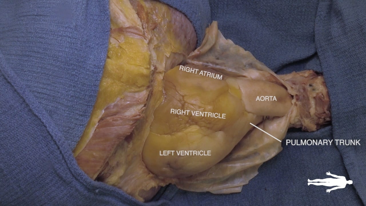 Labels (top to bottom): Right atrium, aorta, right ventricle, pulmonary trunk, left ventricle