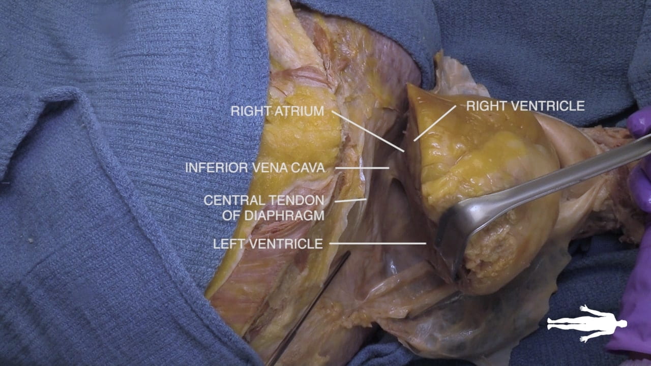 Labels (top to bottom): Right atrium, right ventricle, inferior vena cava, central tendon of diaphragm, left ventricle