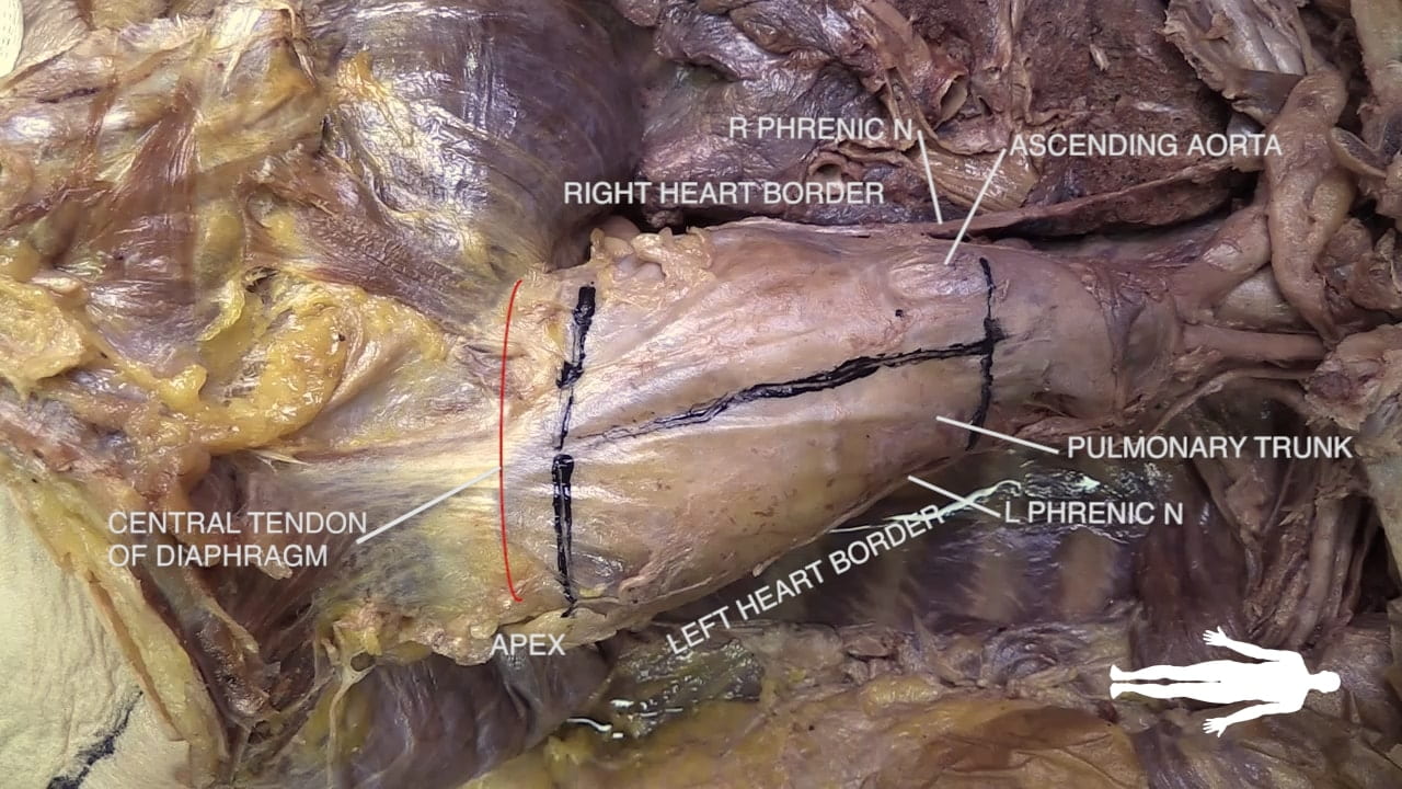 Labels (left to right): Central tendon of diaphragm, apex, right heart border, left heart border, r phrenic n, ascending aorta, l phrenic n, pulmonary trunk