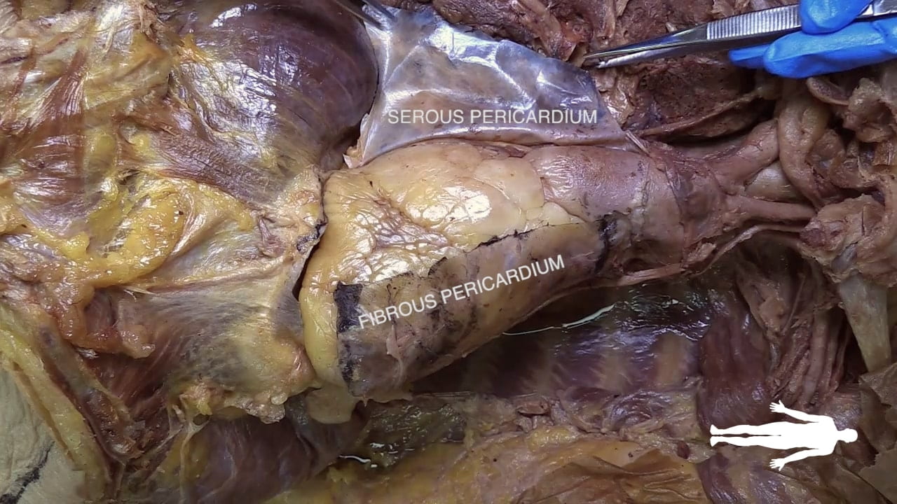 Labels (top to bottom): Serous pericardium, fibrous pericardium