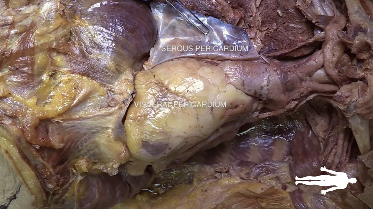 Labels (top to bottom): Serous pericardium, fibrous pericardium