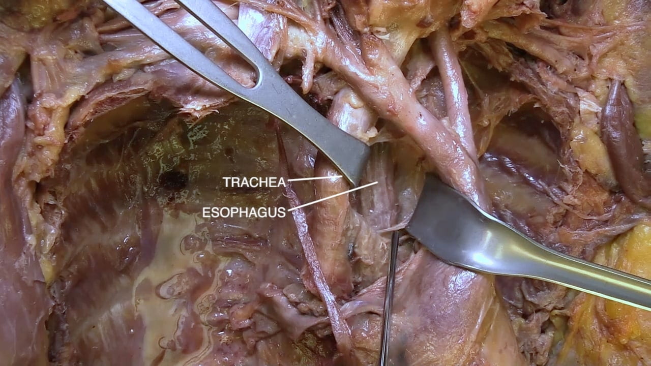 Labels (top to bottom): Trachea, esophagus