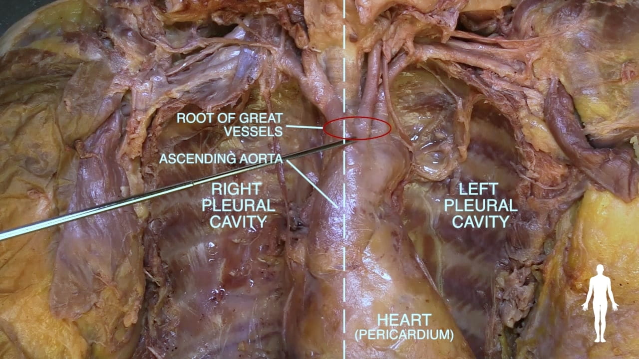 Labels (Top to bottom): Root of great vessels, ascending aorta, right pleural cavity, left pleural cavity, heart (pericardium)