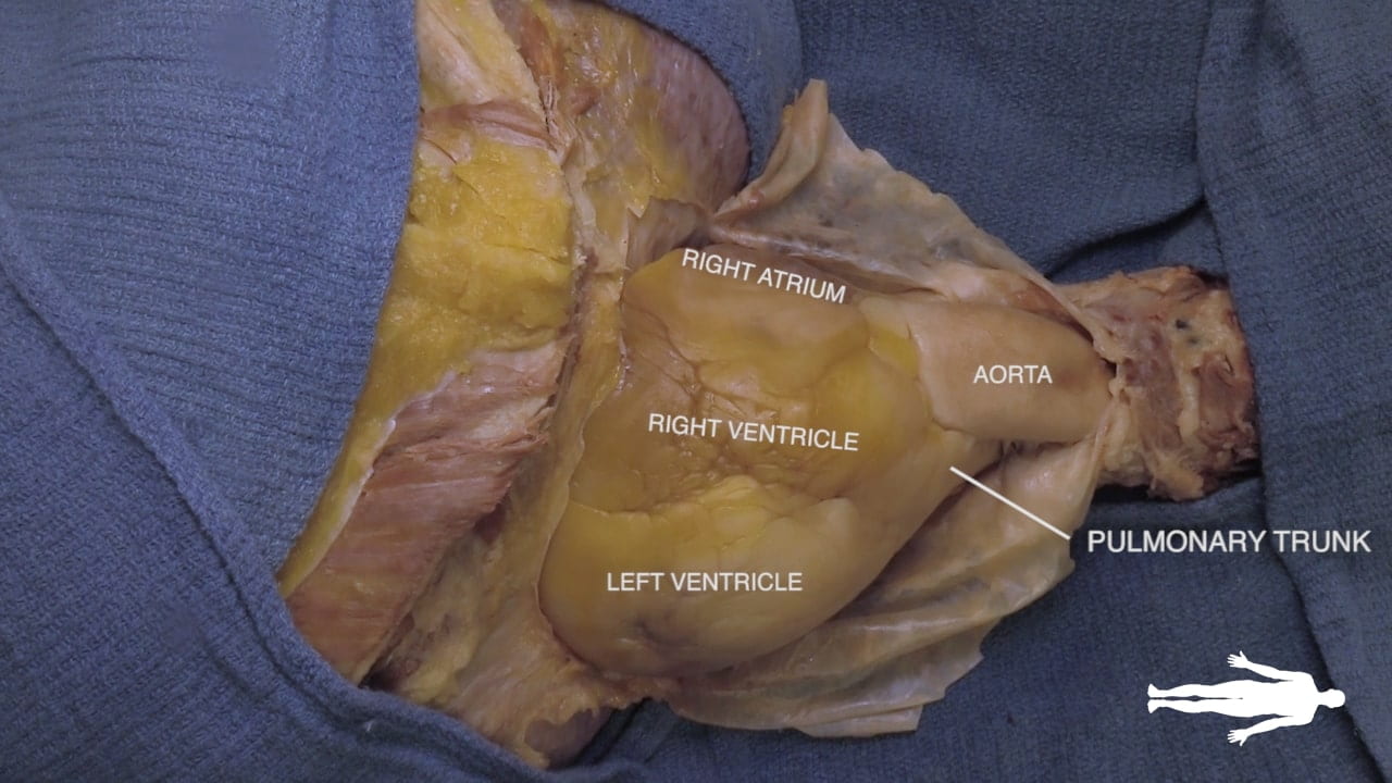 Labels (top to bottom): Right atrium, aorta, right ventricle, pulmonary trunk, left ventricle