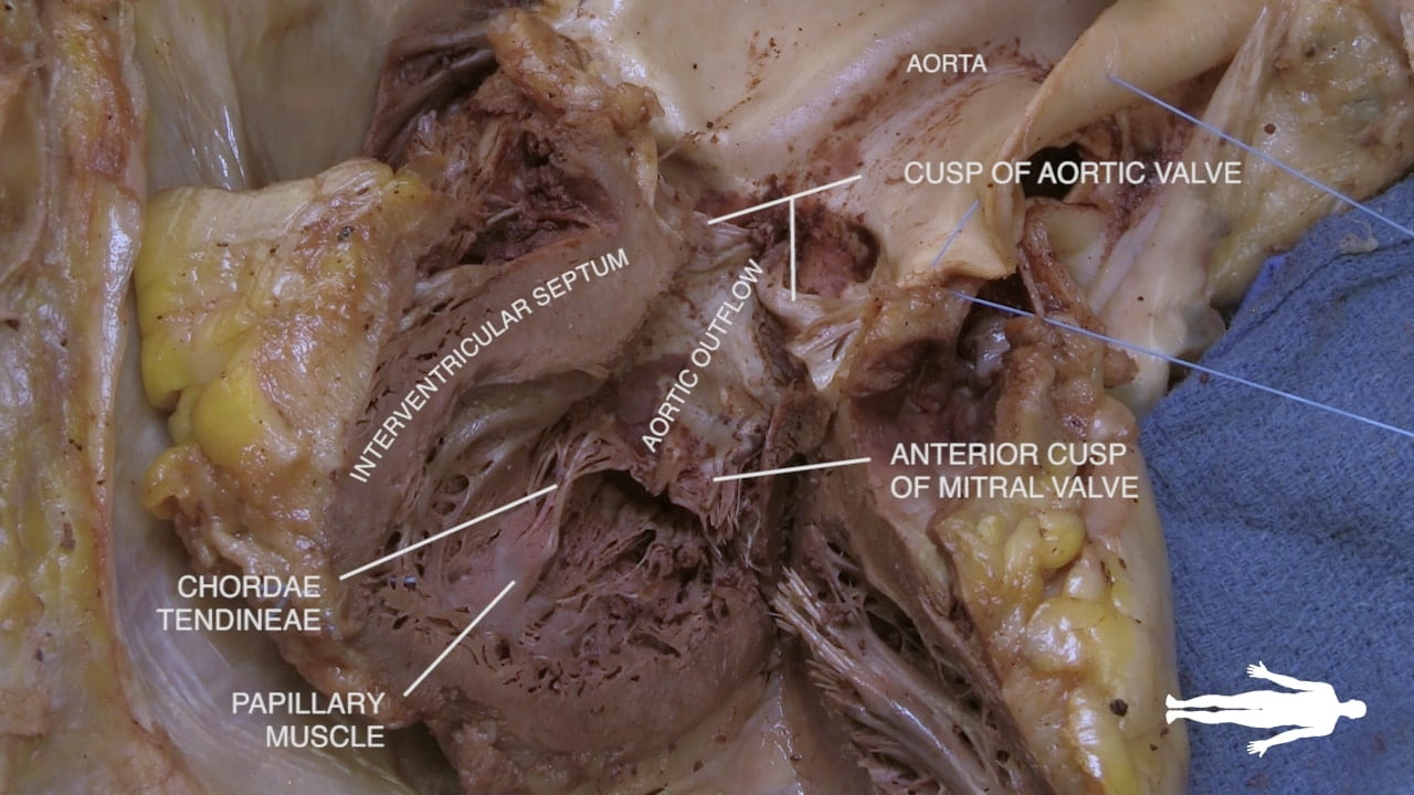 Labels (left to right): Chordae tendineae, papillary muscles interventricular septum, aortic outflow, aorta, cusp of aortic valve, anterior cusp of mitral valve