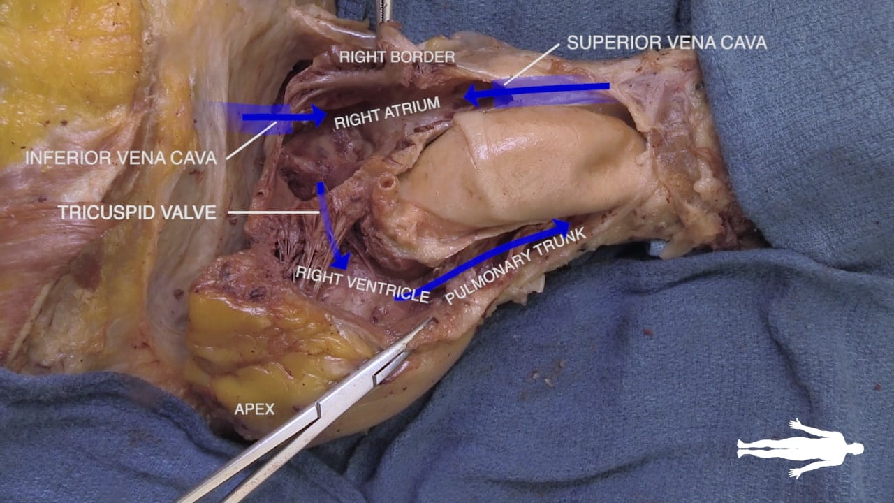 Labels (left to right): Inferior vena cava, tricuspid valve, right border, right atrium, right ventricle, pulmonary trunk, superior vena cava