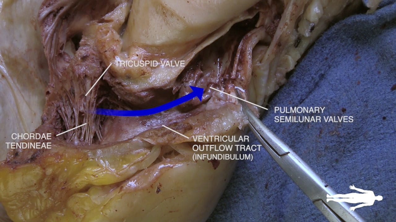 Labels (left to right): Chordae tendineae, tricuspid valve, ventricular outflow tract (infundibulum), pulmonary semilunar valves