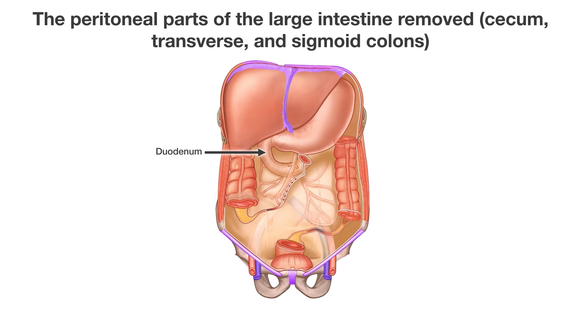 Label: Duodenum