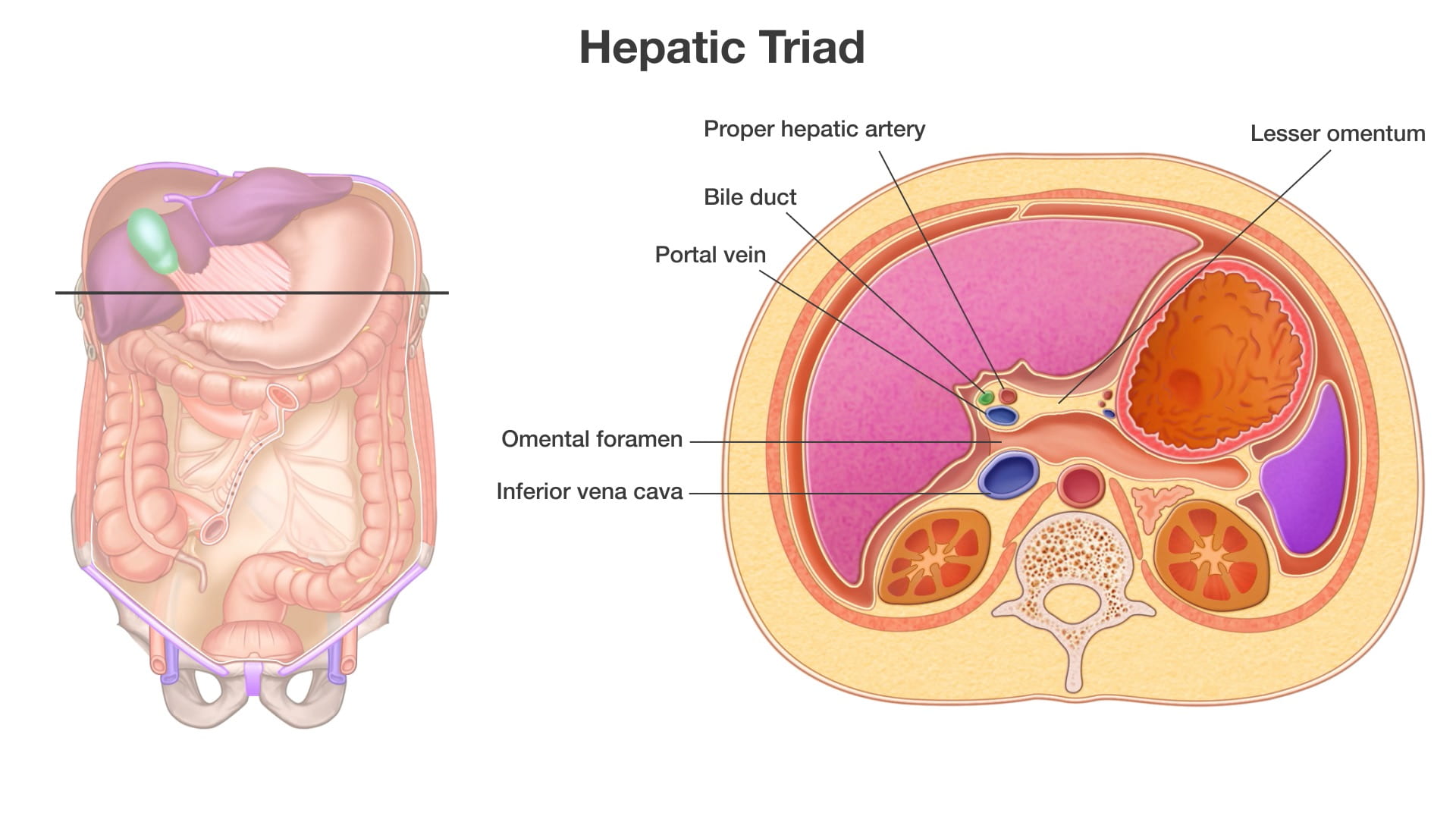 Labels (top to bottom): Proper hepatic artery, lesser omentum, bile duct, portal vein, omental foramen, inferior vena cava