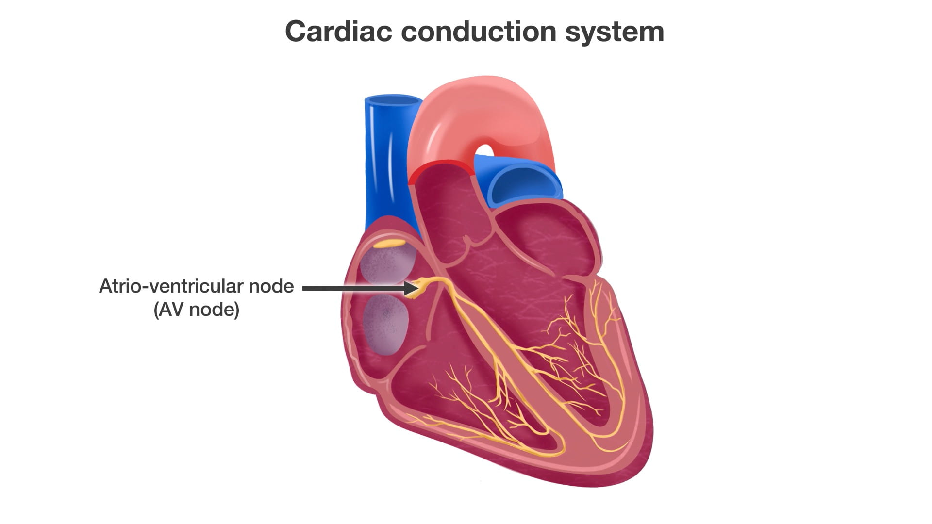 Label: Atrio-ventricular node (AV node)