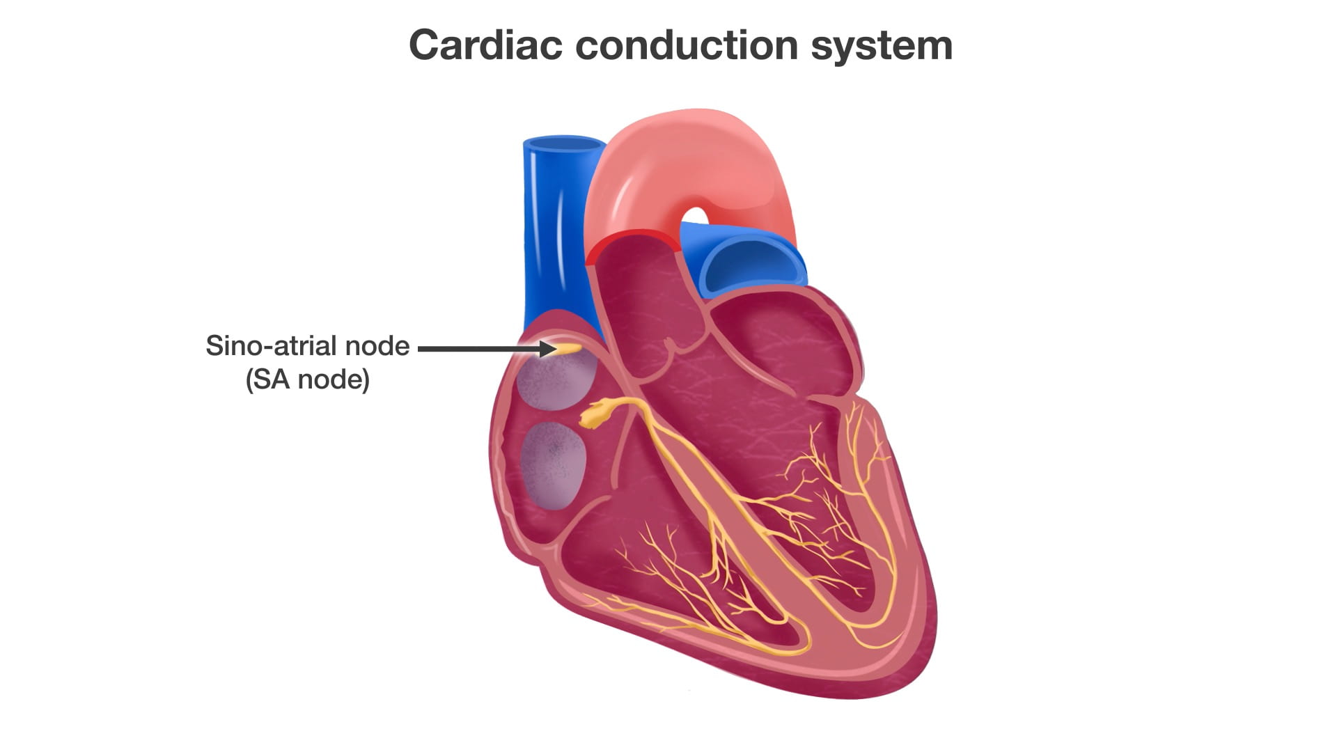 Label: Sino-atrial node (SA node)