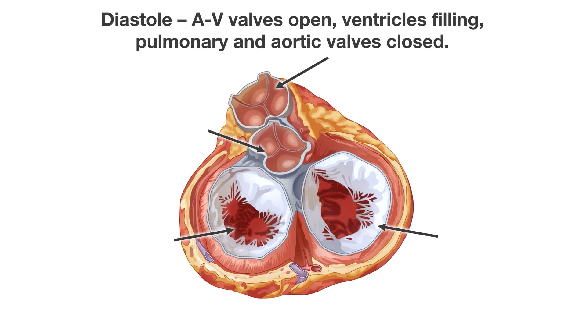 Diastole - A-A valves open, ventricles filling, pulmonary and aortic valves closed.