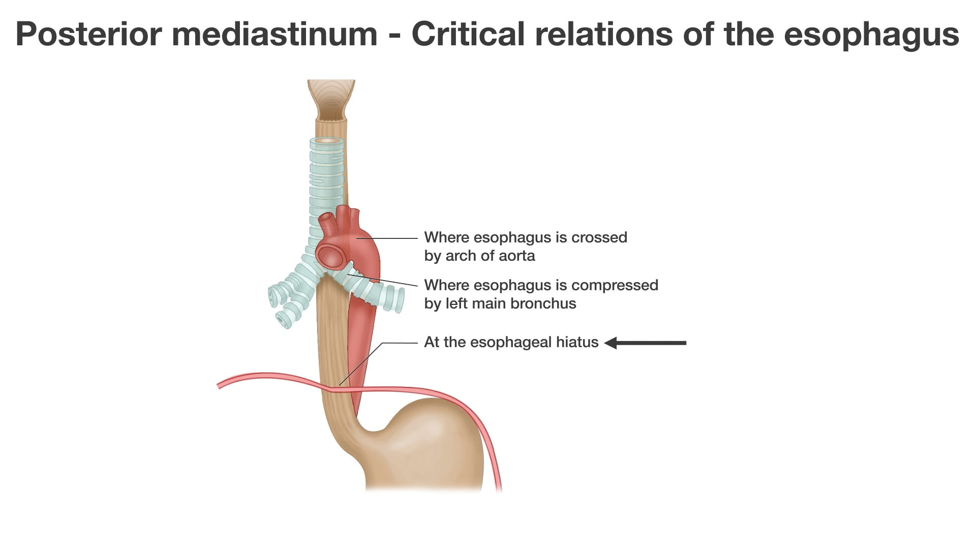 Labels (top to bottom): Where esophagus is cross by arch of aorta, where esophagus is compressed by left main bronchus, at the esophageal hiatus