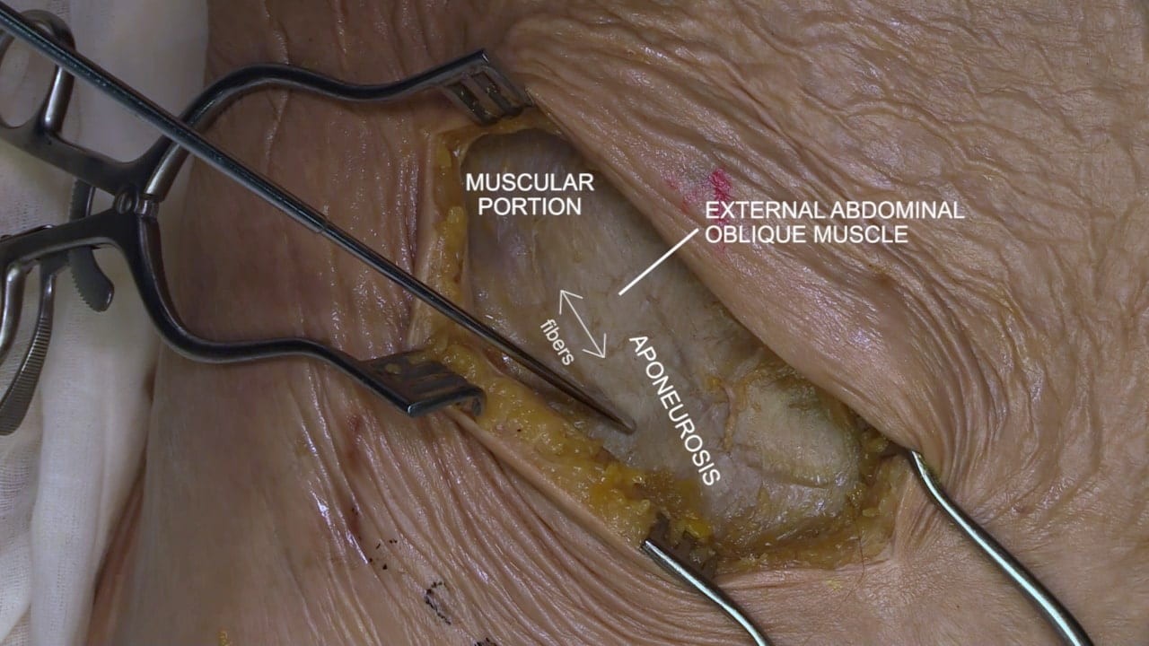 Labels (top to bottom): Muscular portion, external abdominal oblique muscle, fibers, aponeurosis