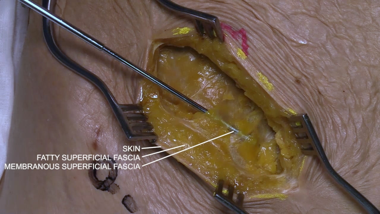 Labels (top to bottom): Skin, fatty superficial fascia, membranous superficial fascia