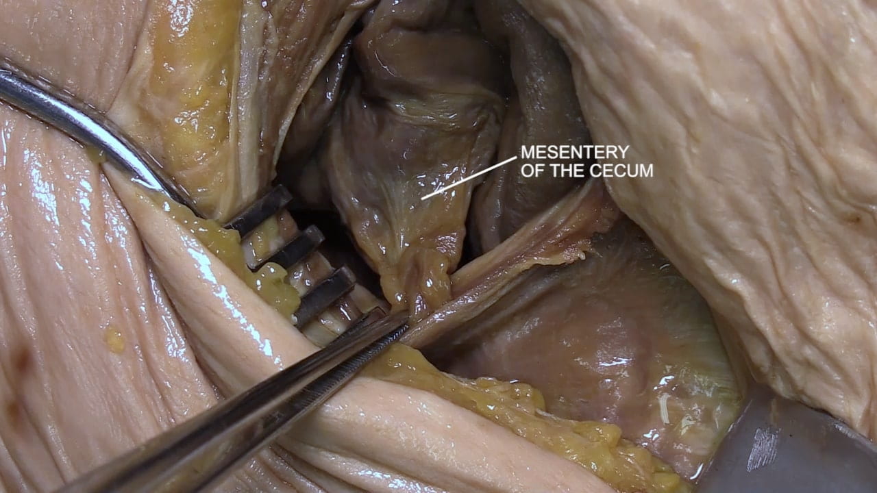 Label: Mesentery of the cecum