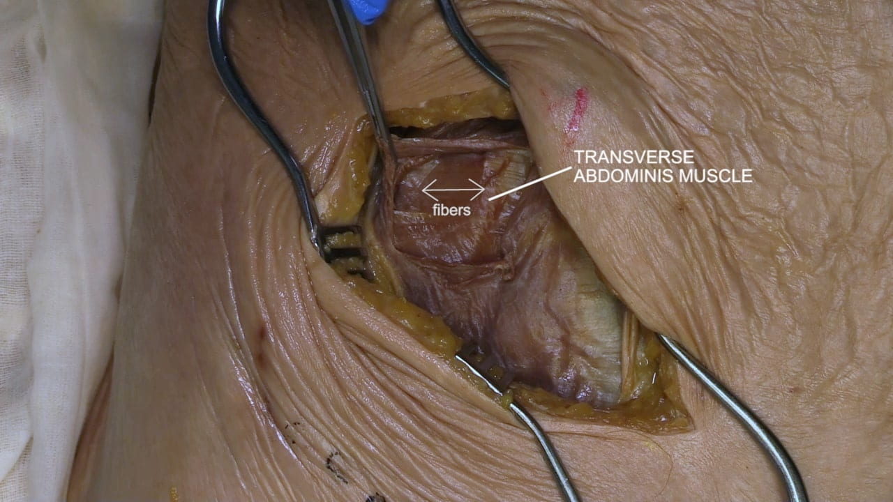 Labels (top to bottom): Transverse abdominis muscle, fibers