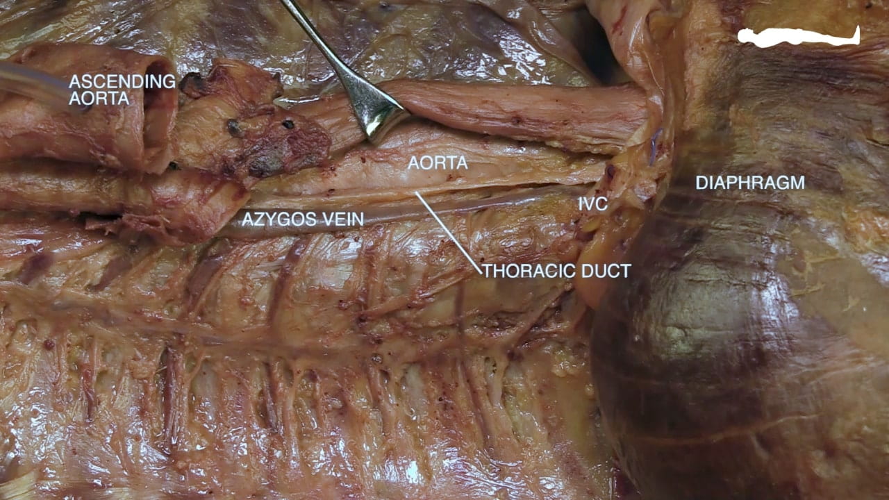 Labels (top to bottom): Ascending aorta, aorta, diaphragm, IVC, azygos vein, thoracic duct