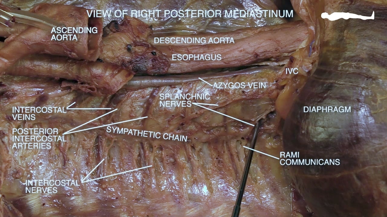 Title: view of right posterior mediastinum Labels (top to bottom): Ascending aorta, descending aorta, esophagus, IVC, azygos vein, splanchnic nerves, diaphragm, intercostal veins, posterior intercostal artery, sympathetic chain, rami communicant, intercostal nerves