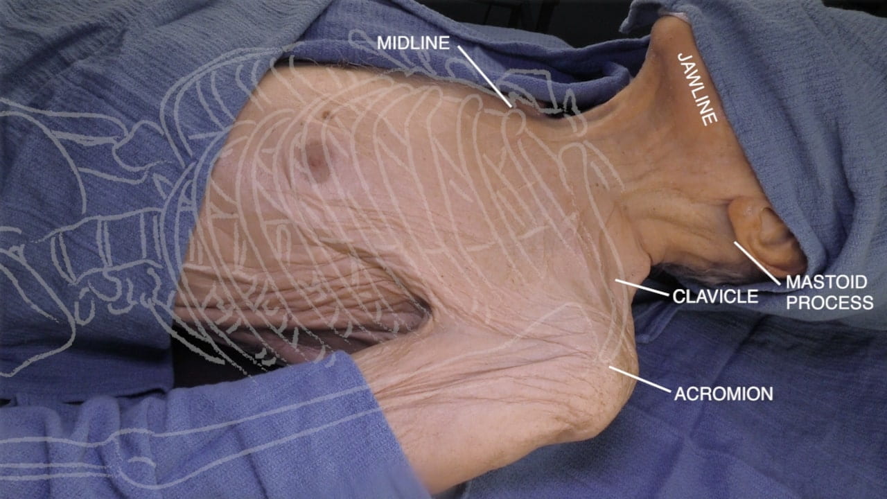 Labels (top to bottom): Midline, jawline, mastoid process, clavicle, acromion