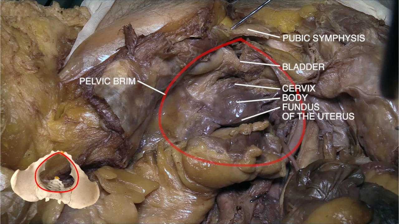 Labels (top to bottom): Pubic symphysis, bladder, pelvic brim, cervix, body, fungus of the uterus