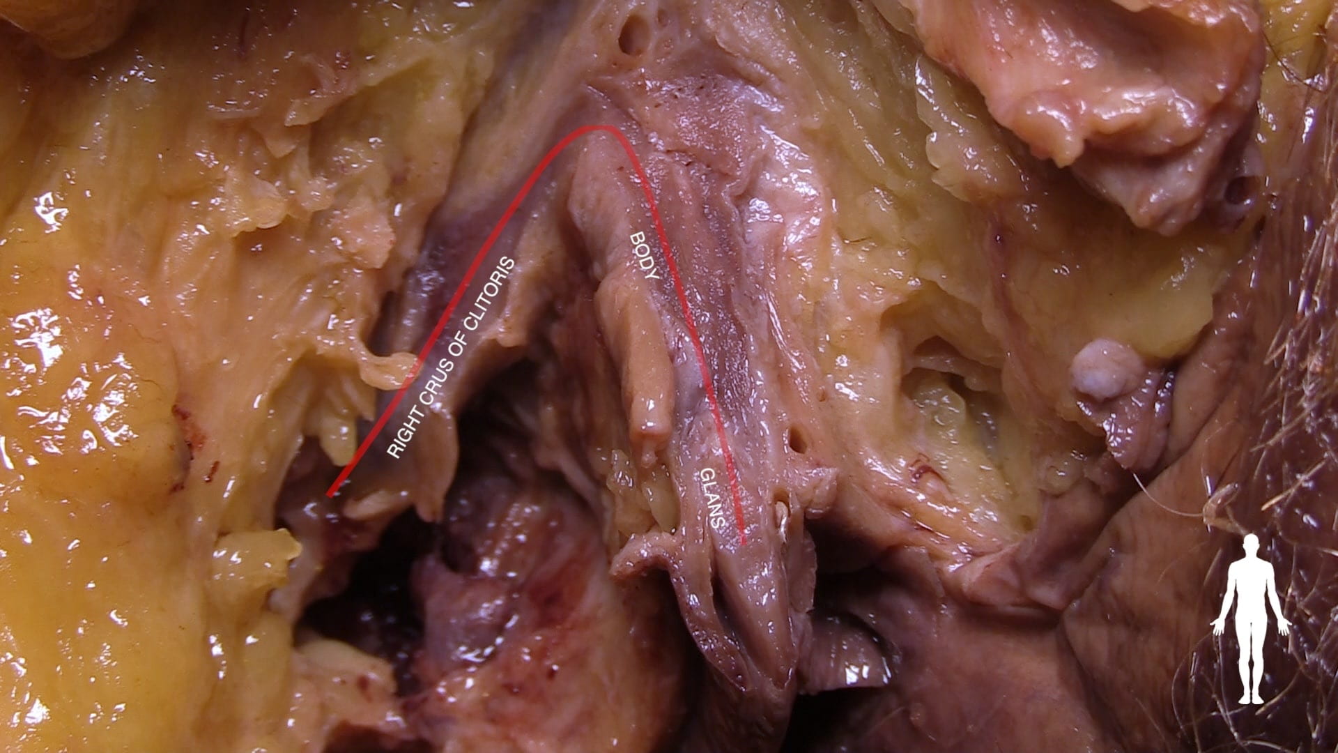 Labels (left to right): Right crus of clitoris, body, glans