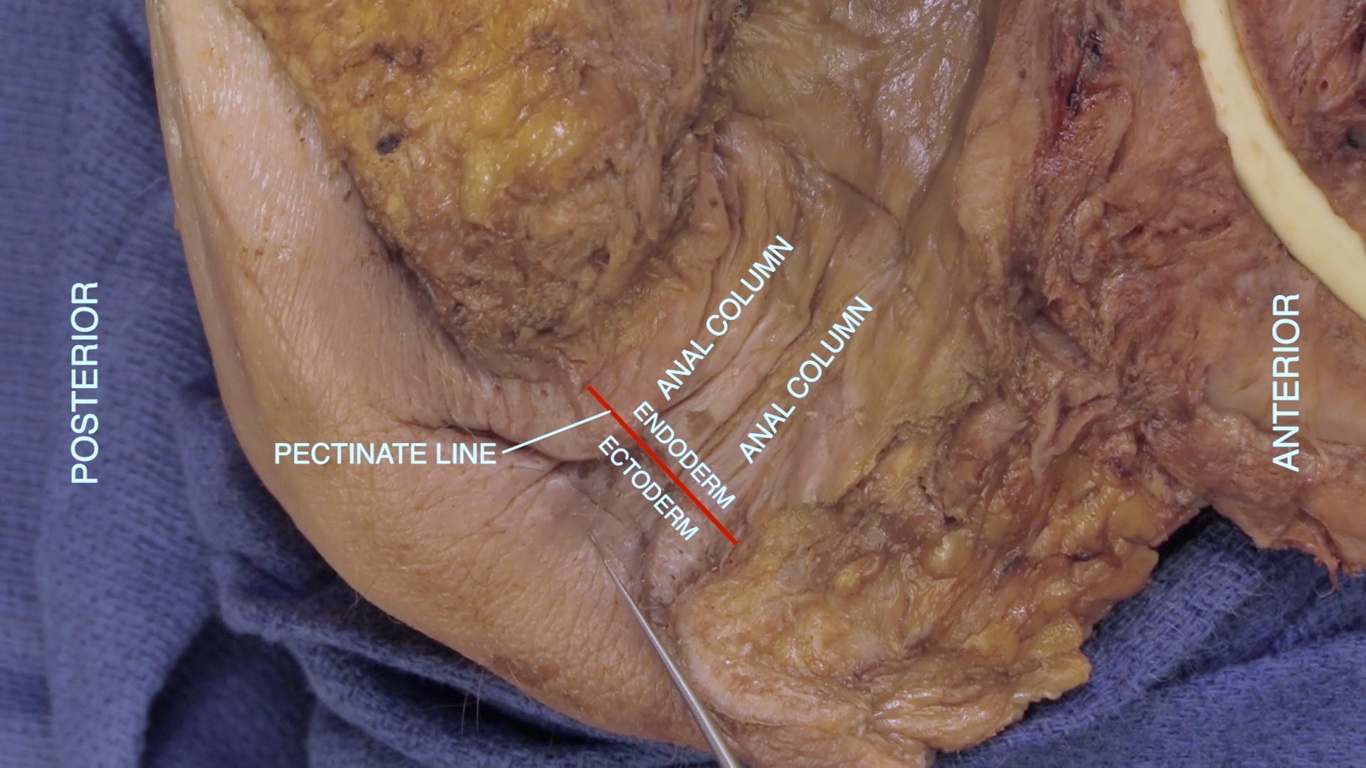 Labels (left to right): Posterior, pectinate line, ectoderm, endoderm, anal column, anal column, anterior