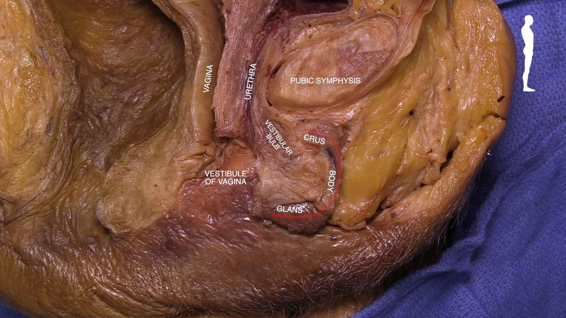 Labels (left to right): caging, vestibule of vagina, urethra, vestibular bulb, glands, crus, body, pubic symphysis