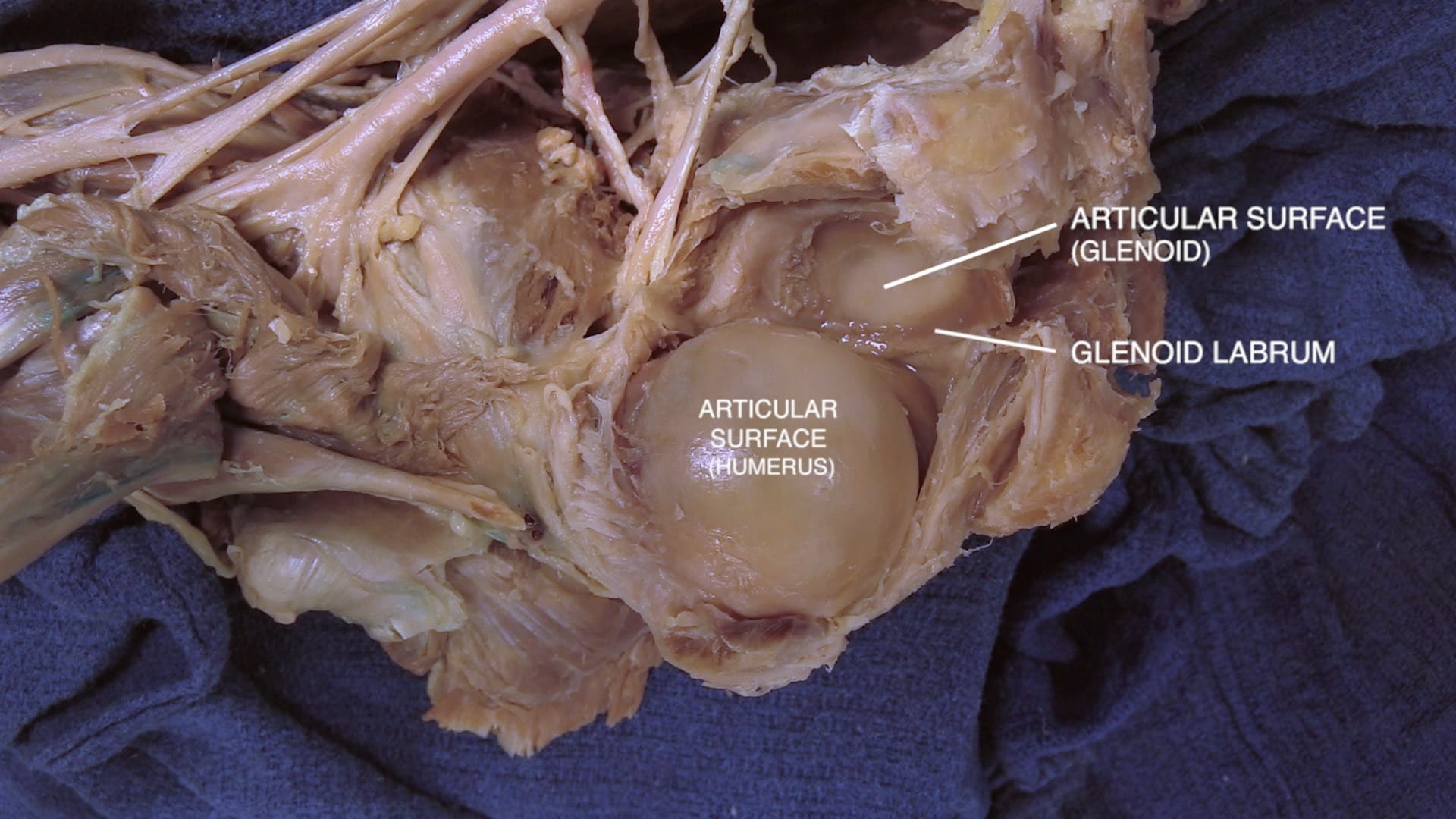 Labels (top to bottom): articular surface (glenoid), glenoid labrum, articular surface (humerus)