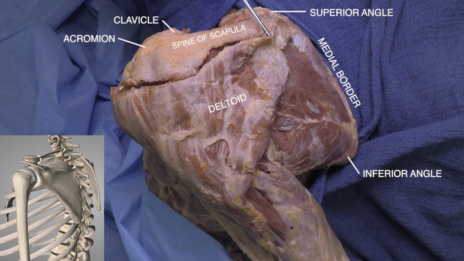 Labels (Left to right): Acromion, clavicle, spine of scapula, deltoid, superior angle, medial border, inferior angle