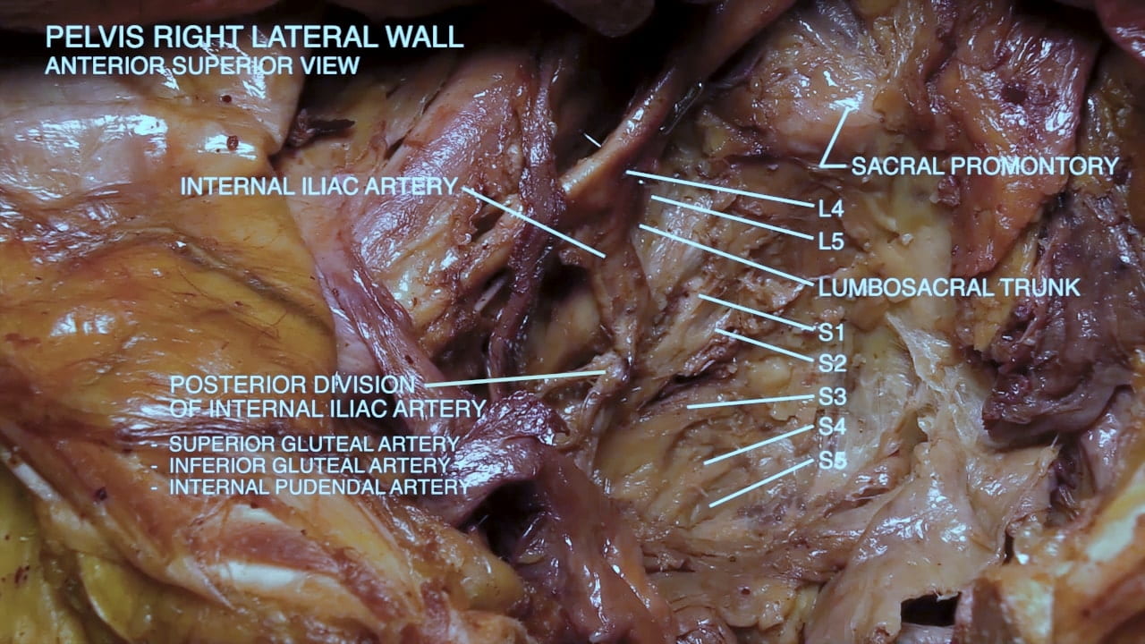 Labels (top to bottom): Sacral promontory, internal iliac artier, L4, L5, Lumbosacral trunk, S1, S2, Posterior division of internal iliac artery: - Superior gluteal artery - inferior gluteal artery - internal pudenal artery, S4, S5