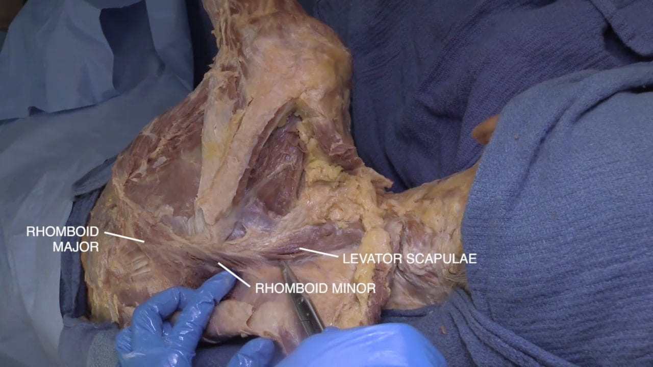 Labels (top to bottom): Rhomboid major, levator scapulae, rhomboid minor