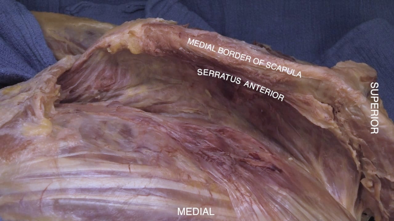 Labels (top to bottom): Medial border of scapula, serratus anterior, superior, medial