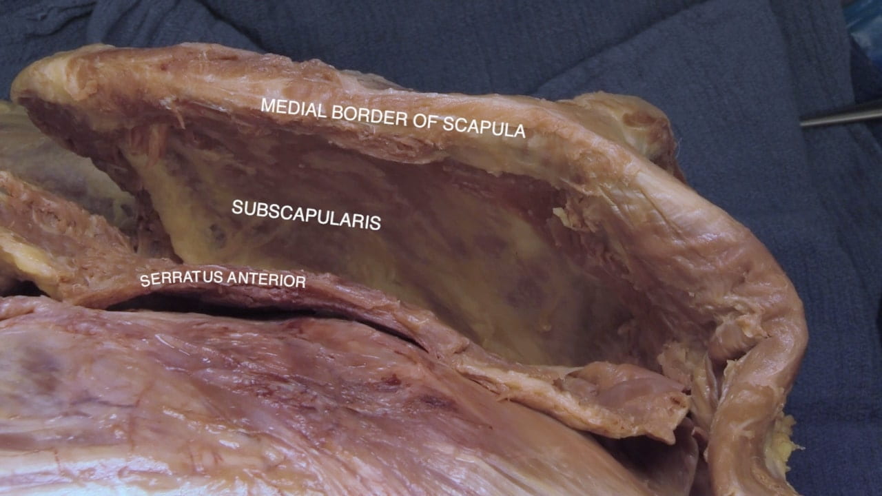 Labels (top to bottom): Medial border of scapula, subscapularis, serratus anterior