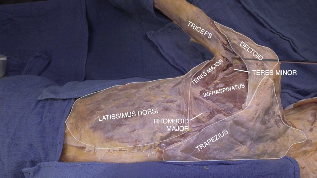 Labels (top to bottom): Triceps, deltoid, teres major, teres minor, infraspinatus, latissimus dorsi, rhomboid major, trapezius