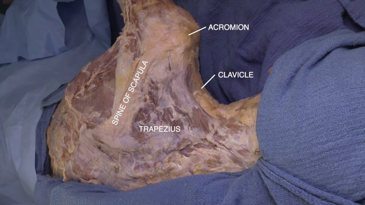 Labels (top to bottom): Acromion, clavicle, spine of scapula, trapezius