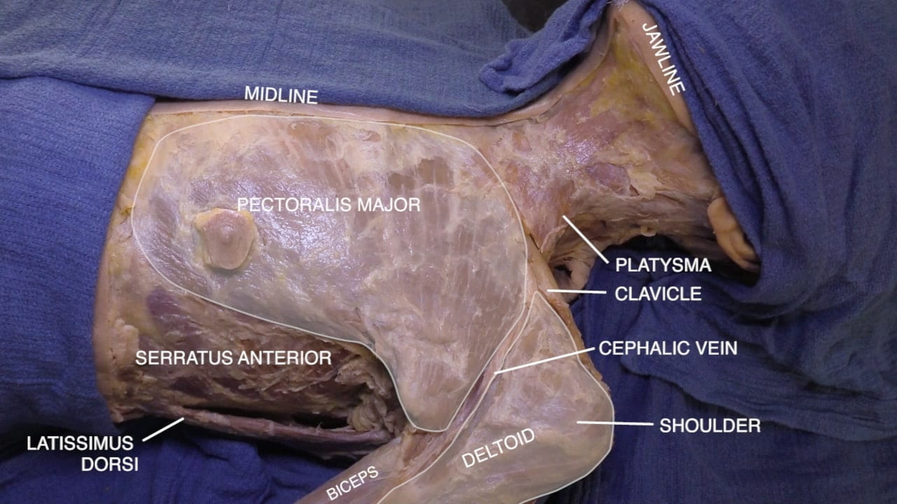 Labels (top to bottom): Jawline, midline, pectoralis major, platysma, clavicle, cephalic vein, serratus anterior, shoulder, latissimus dorsi, deltoid, biceps