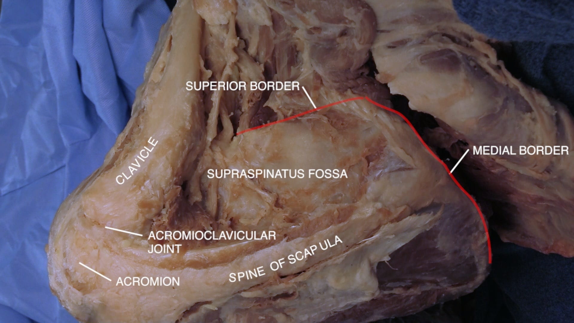 Labels (top to bottom): Superior border, clavicle, medial border, supraspinatus fossa, acromioclavicular joint, spine of scapula, acromion