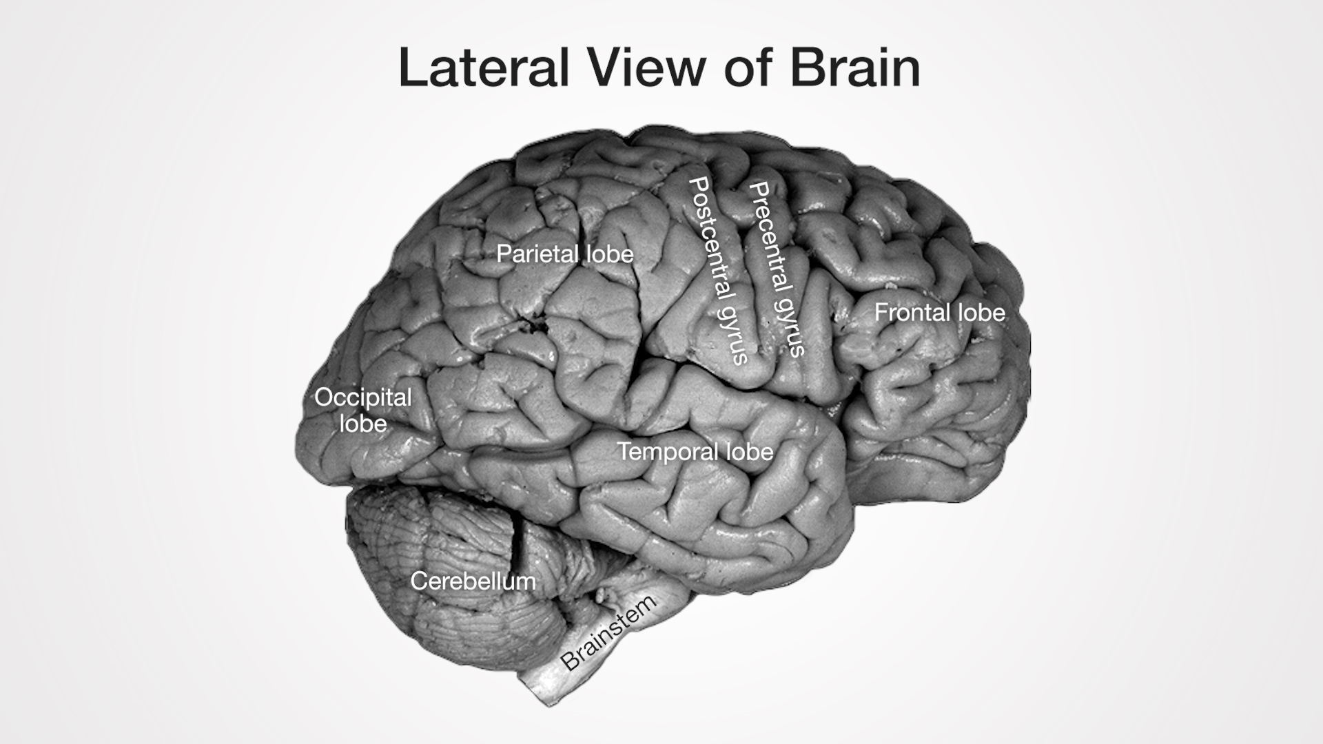 Labels (left to right): Occipital lobe, cerebellum, parietal lobe, brainstem, temporal lobe, postcentral gyrus, precentral gyrus, frontal lobe