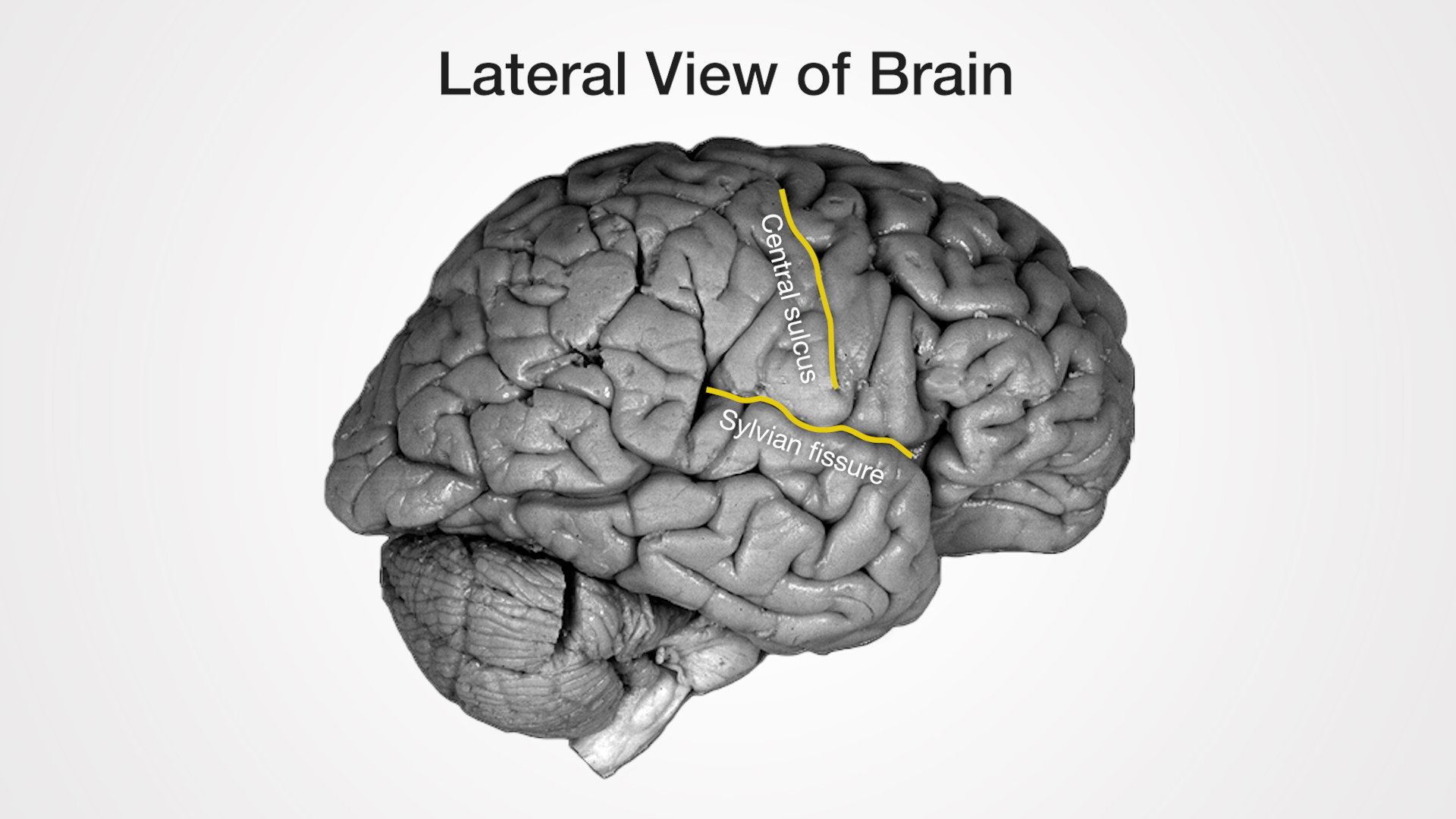 Labels (top to bottom): Central sulcus, Sylvian fissure